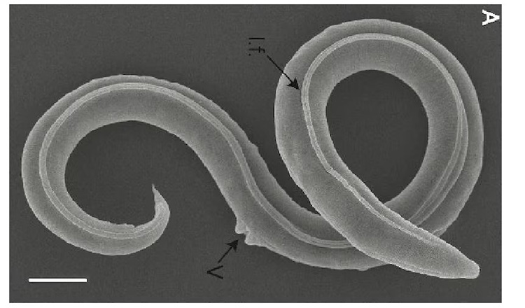 Organism Hibernation, Nematode Panagrolaimus kolymaensis fot Alexei V_Tchesunov_Anastasia Shatilovich_Institute of Physicochemical and Biological Problems in Soil Science RAS