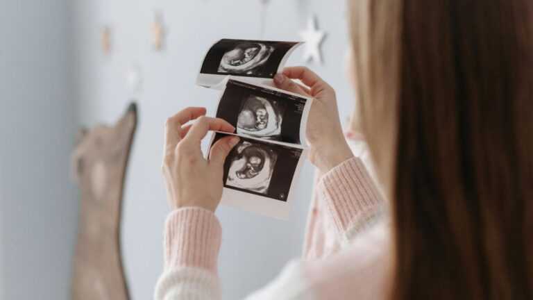 Od czego zależy płeć dziecka: kobieta ogląda zdjęcia USG ciązy